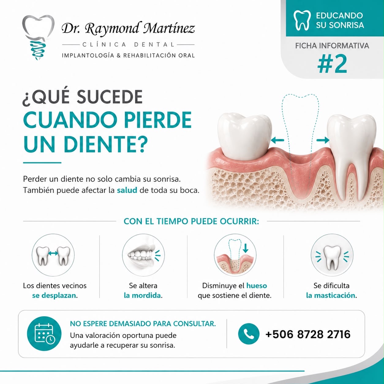 ¿Qué sucede cuando pierde un diente?