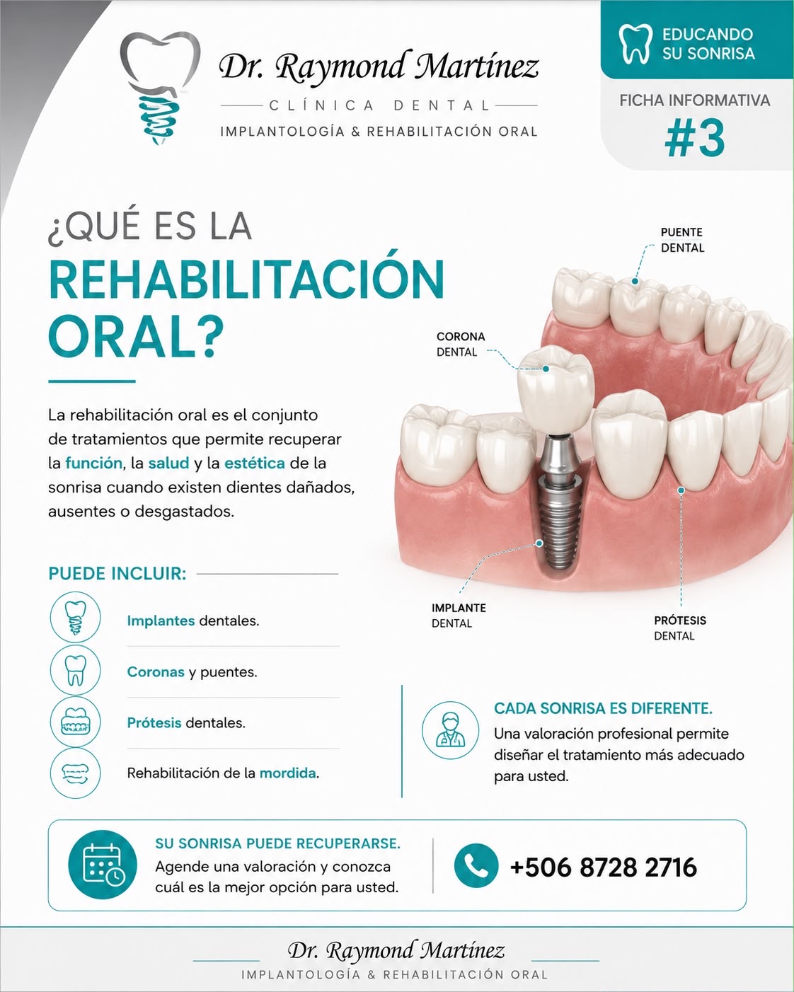 ¿Qué es la rehabilitación oral?