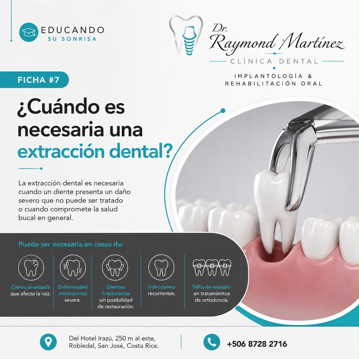 ¿Cuándo es necesaria una extracción dental?